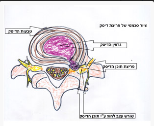 פריצת דיסק